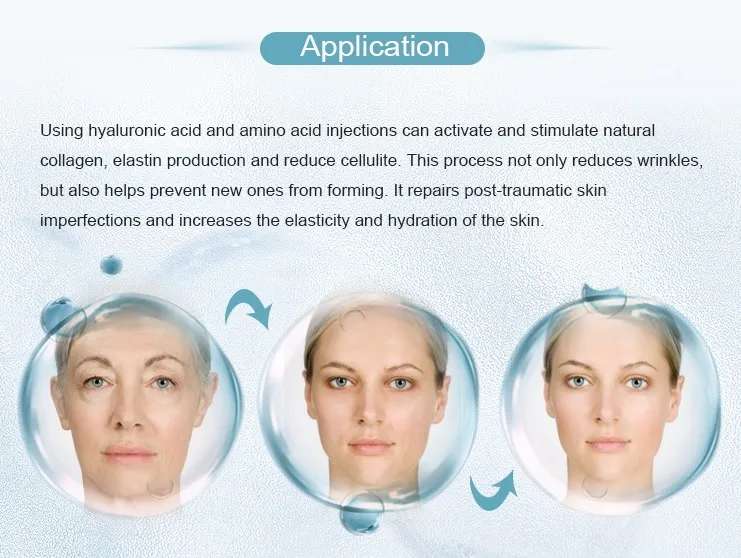 12mg 20mg 36mg 60mg 100mg Non Crosslinked Sodium Hyaluronate Injection Liquid for Whole Face Injection