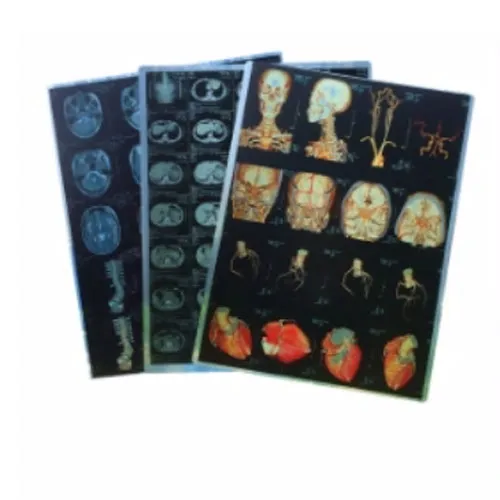 13*17in Roll Packing Blue Inkjet Medical Digital Dry Images