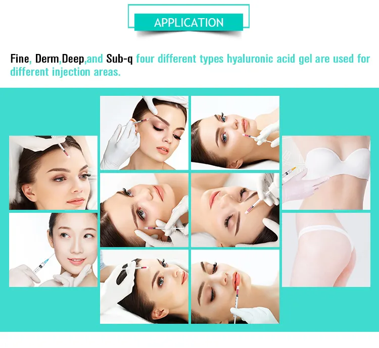 1ml CE Approved Hyaluronic Acid Ha Filler Hyaluronic Acid Korea Dermal Filler for Face