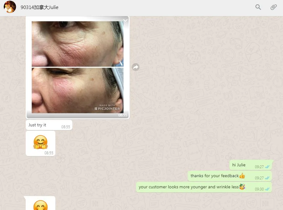 2021 High Quality Cross Linked Acido Hialuronico Breast Injection Filler