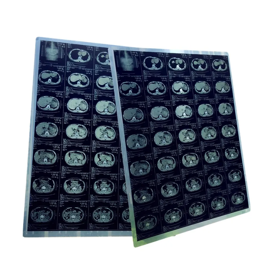 28cm*36cm Medical Dry Film for Epson 1800 and Epson 1300 Inkjet Printer