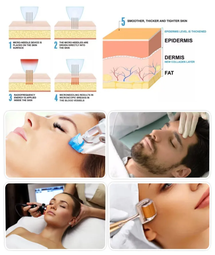 Anti-Aging Derm Pen Skin Care Retinol Meso Hyaluronic Acid 5ml