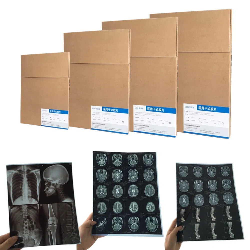 Blue/White Base Medical Dry Imaging Films 14X17 35X43 A3