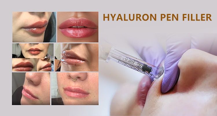 Bouliga Moderate Price 0.3ml Ampoule and 0.3ml Hyaluron Pen