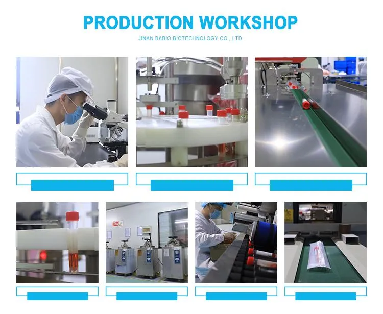 Customize Packing Mycoplasma Manufacturer Mass Production Sales Pneumoniae Igm Test Kit
