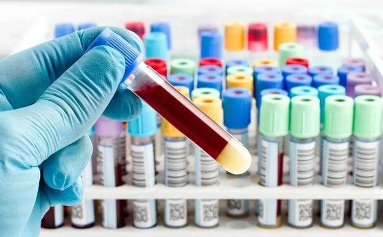 Customized Rubber Stopper for The Blood Collection Tube EDTA Vacuum