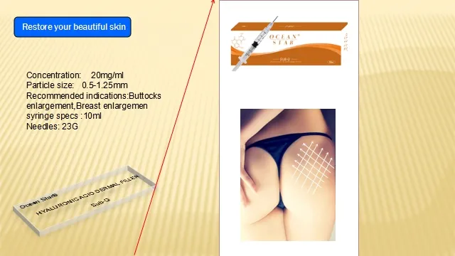 Dermal Filler Hyaluronic Acid Filler Korea Dermal Filer for Facial Injection