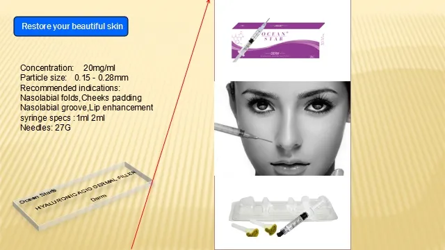 Dermal Filler Hyaluronic Acid Filler Korea Dermal Filer for Facial Injection