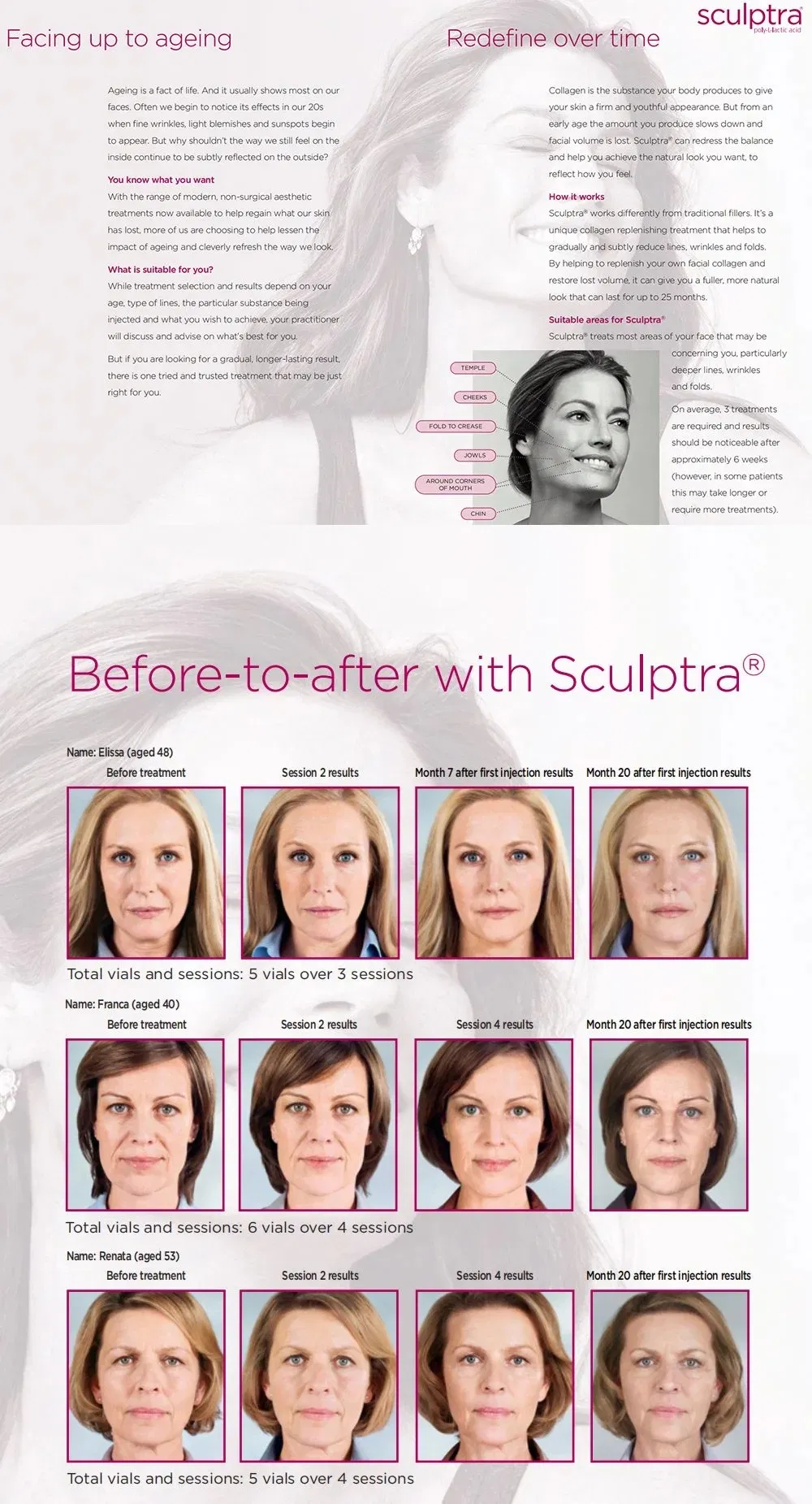 Factory Direct Sales of Genuine Products Stimulate The Production of Collagen, Plla Powder Poly L Lactic Acid Sculpture Face
