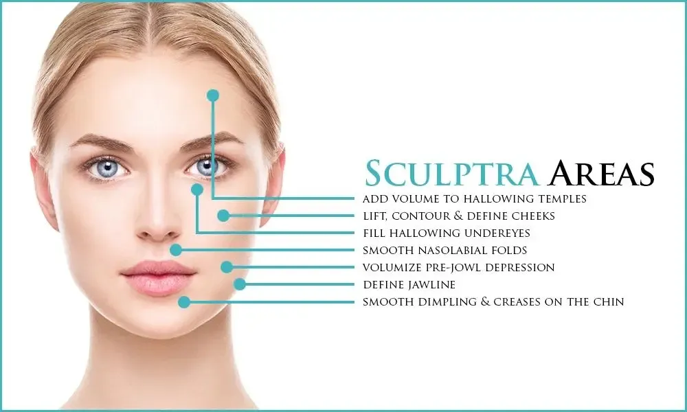 High Quality Stimulates Collagen Production Plla Powder Poly L Lactic Acid Sculptra for Face