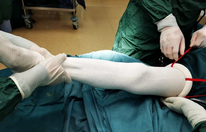 Latex-Free Silicone Elastic Ring Disposable Sterile Exsanguinating Tourniquet Cuff for Bloodless Limb Surgery Orthopedic Non-Pneumatic Equipment