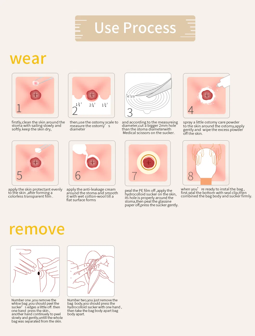 Material Medical Instrument Brown Non-Woven Two Piece Hydrocolloid Ostomy Clip Bag Recycle Illeostomy