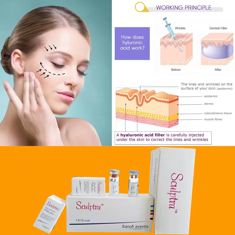 New Product Hyaluronic Acid Sculptra Dermal Filler