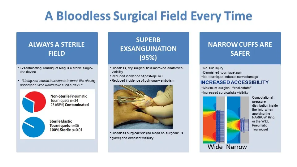 Sterilized Disposable Exsanguination Occlusion Tourniquet Cuff with Silicone Ring Medical/Surgical Product to Stop Bloodloss in Emergency Aid and Limb Surgeries