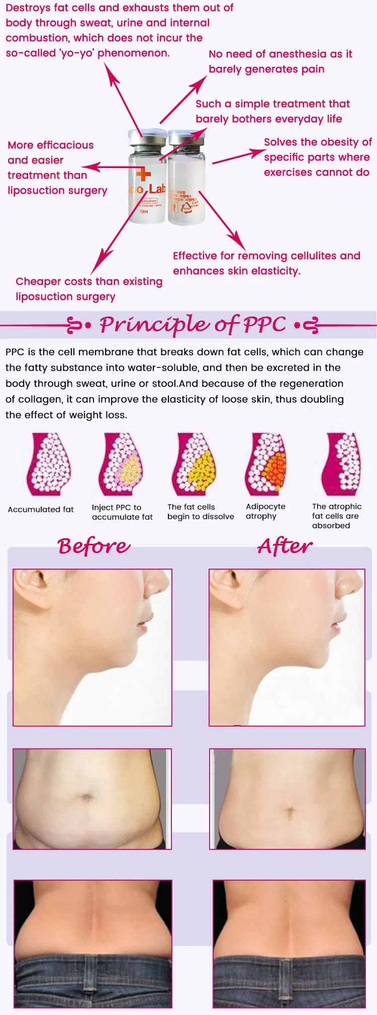 Good Effect V-Line Body Slimming Lipolysis Lipo Lab for Slimming